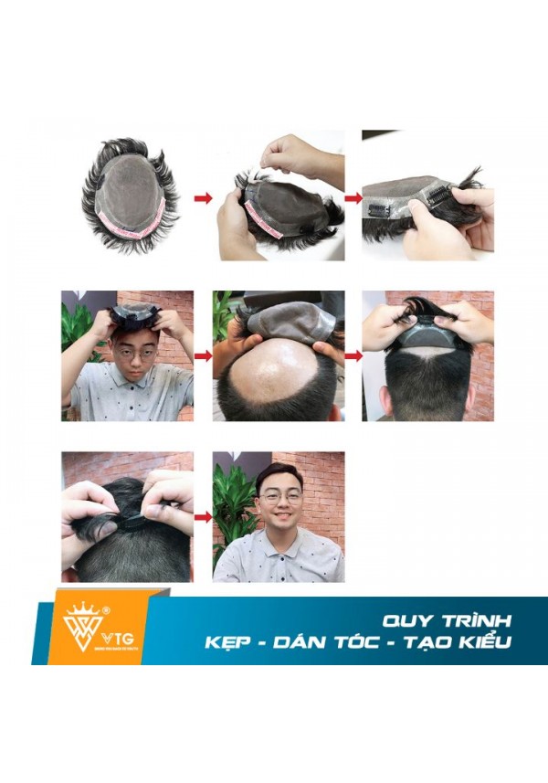 Tóc Giả Dạng Kẹp Che Hói Đầu Nam - VTG D02